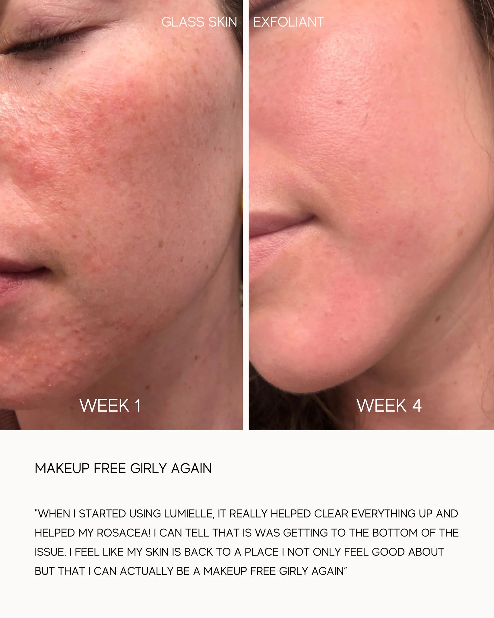 Lumielle Glass Skin A powerful exfoliant that dissolves dead skin cells without irritation. This natural acid washes away dullness to reveal youthful-looking, firm, luminous skin