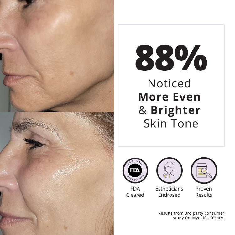 MyoLift™ Mini Home Care Kit Before and After 2