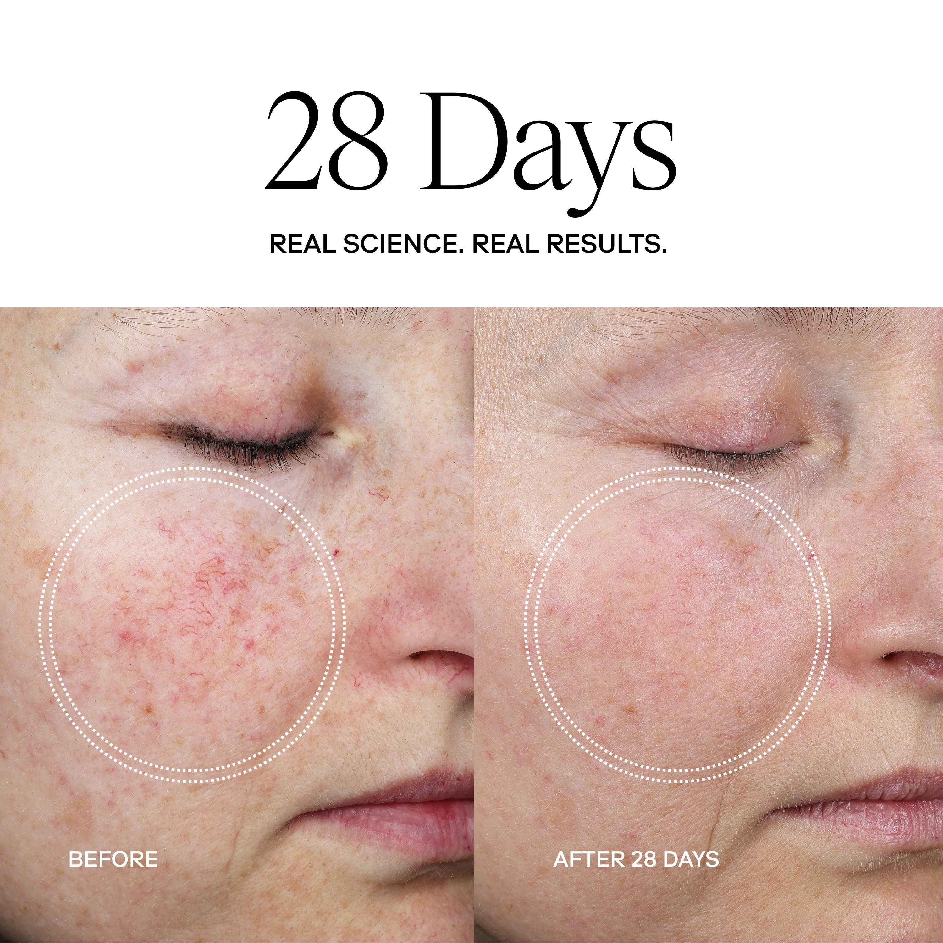 Exoceuticals PLUS® Anti-Aging Cream / eXo³ Exosomes®