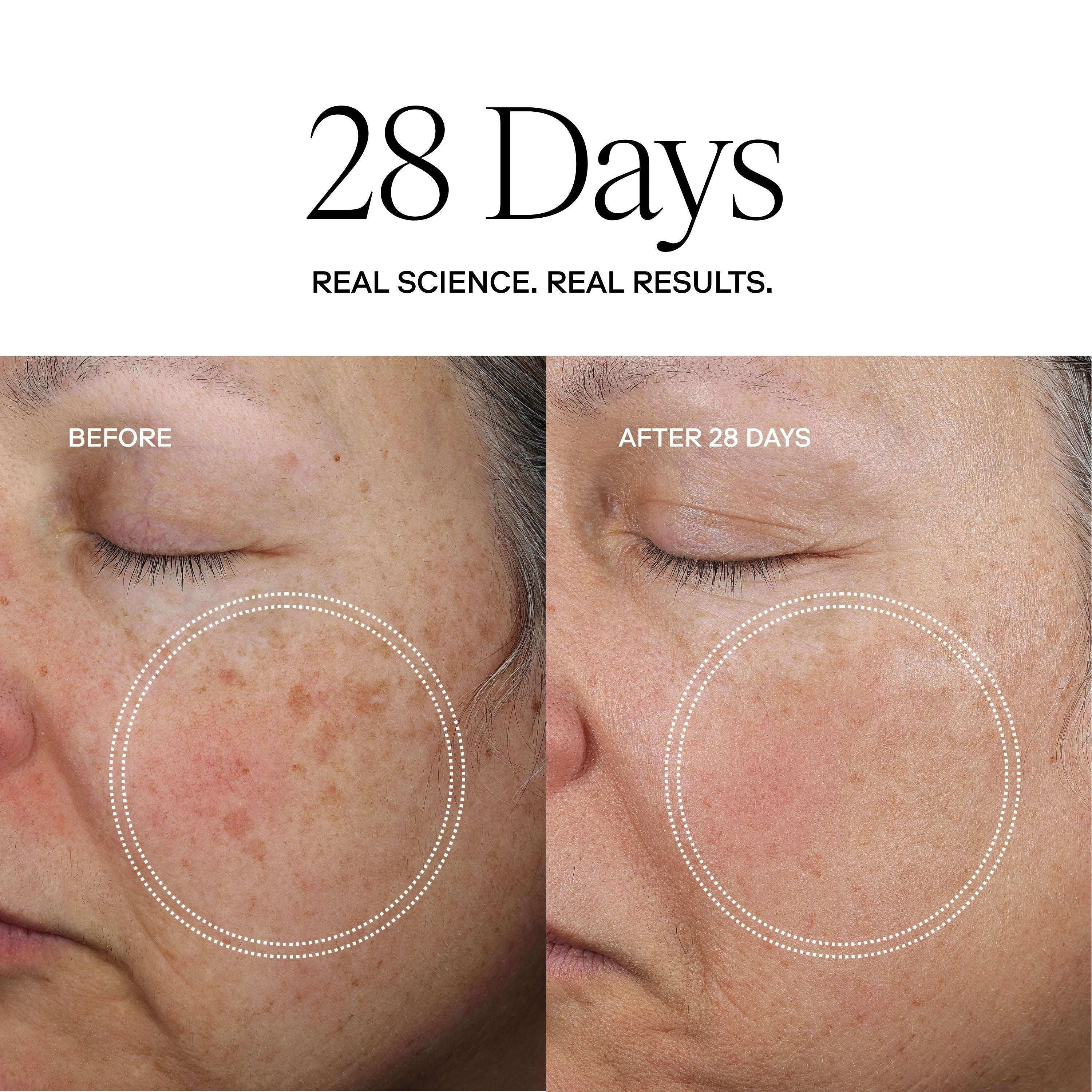 Exoceuticals FACE® Perfection Moisturizer / eXo³ Exosomes®