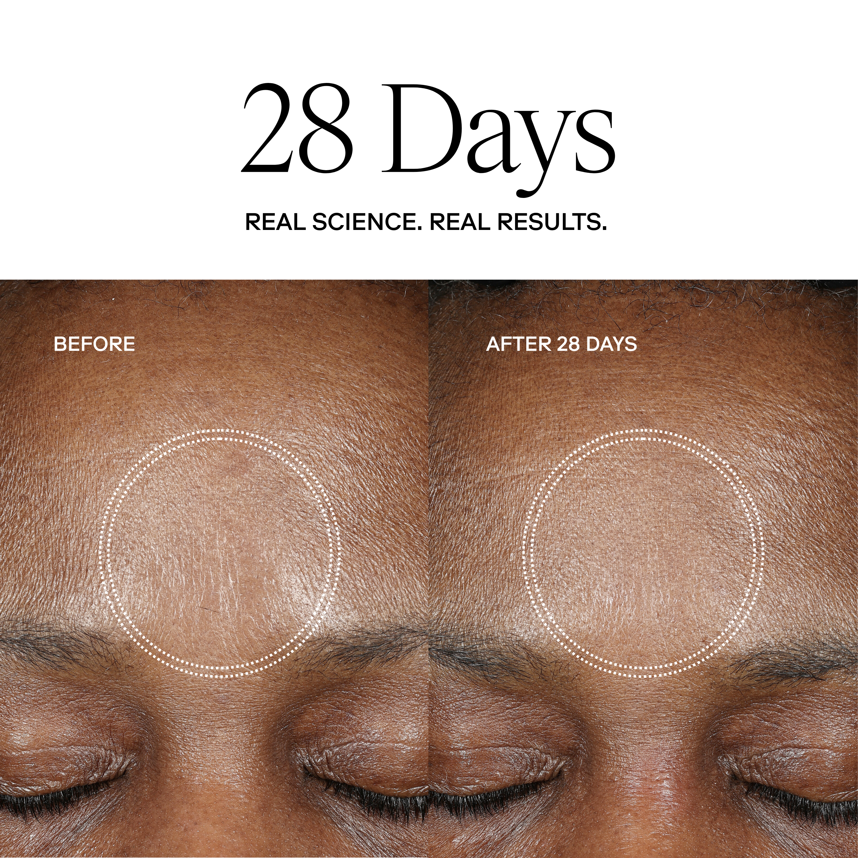 Exoceuticals H-SERUM™ Hyaluronic Acid Treatment / eXo³ Exosomes®