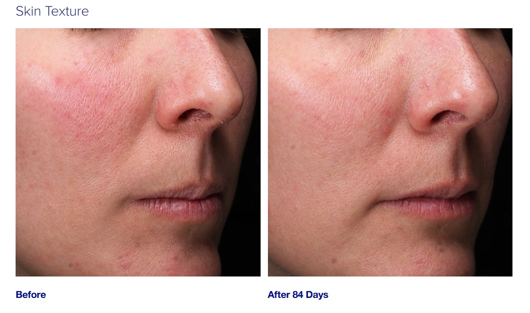 This retinol face cream with bakuchiol smooths fine lines, evens tone, and hydrates for youthful skin.